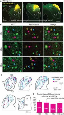 Inhibitory NPY Neurons Provide a Large and Heterotopic Commissural Projection in the Inferior Colliculus